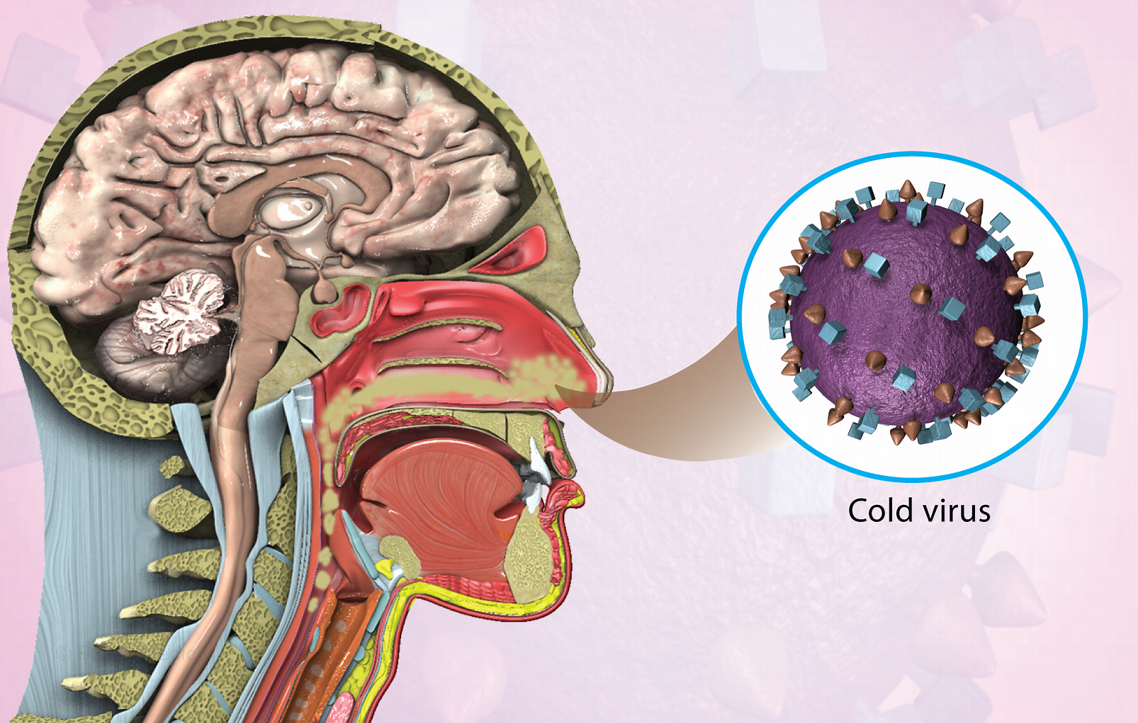 What Causes the Common Cold?