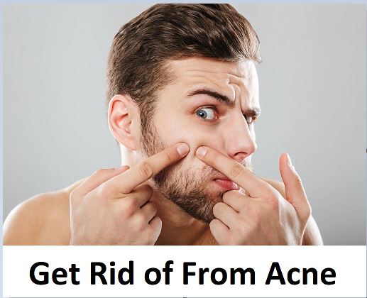 You are currently viewing What Is The Treatment For Acne, Get Rid of Pimples, Home Remedies For Acne
